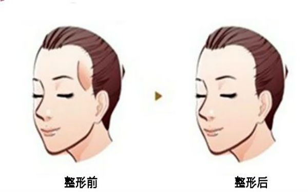 西寧顴骨矯正術(shù)：哪家醫(yī)院口碑好？2023年口碑排名前10的正規(guī)醫(yī)療整形醫(yī)院公布！