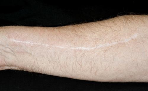 樂(lè)山鼻部矯正醫(yī)生