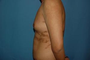 濟(jì)寧哪家醫(yī)院玻尿酸填充手術(shù)技術(shù)專業(yè)？2023年榜單首席整形醫(yī)院揭曉！