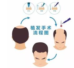 臺(tái)州哪里可以去除下眼皮皺紋？2023臺(tái)州排名前十的美容醫(yī)院推薦