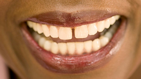 廣州自體脂肪豐全臉醫(yī)生