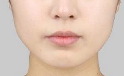 杭州祛除痘印醫(yī)生