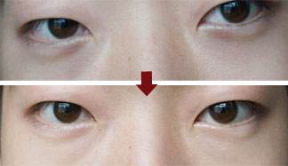 南京哪家醫(yī)院治療黃褐斑比較有口碑？2023南京微針美塑祛斑?？漆t(yī)院排行榜發(fā)布！