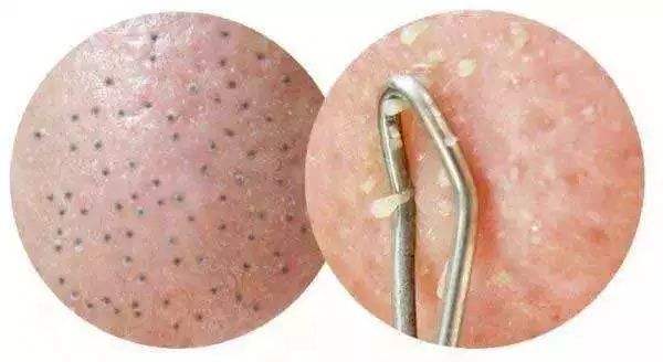 長春無痕動態(tài)隆胸醫(yī)生