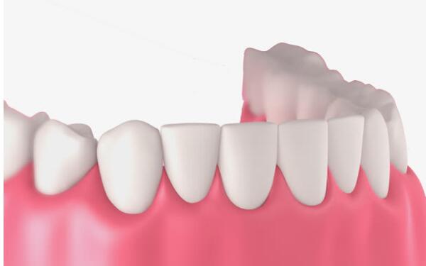 揭秘2023年溫州特色內(nèi)窺鏡額部除皺醫(yī)療美容醫(yī)院排行榜！這些醫(yī)院的名氣有多大？