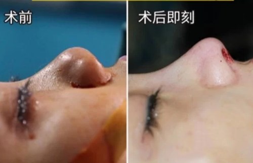 南京最熱門(mén)的環(huán)形精雕吸脂醫(yī)療美容醫(yī)院綜合推薦！2023年排行前十名大揭曉！