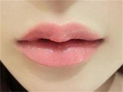 滕州哪家整形醫(yī)院祛痘印效果好？2023年前10名的微雕整容醫(yī)院找到了！