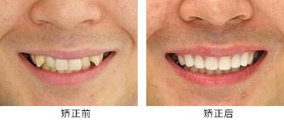 高性價(jià)比的滁州曼托水滴型假體隆胸整形醫(yī)院推薦！2023年滁州曼托水滴型假體隆胸醫(yī)院TOP10口碑排行，實(shí)力醫(yī)