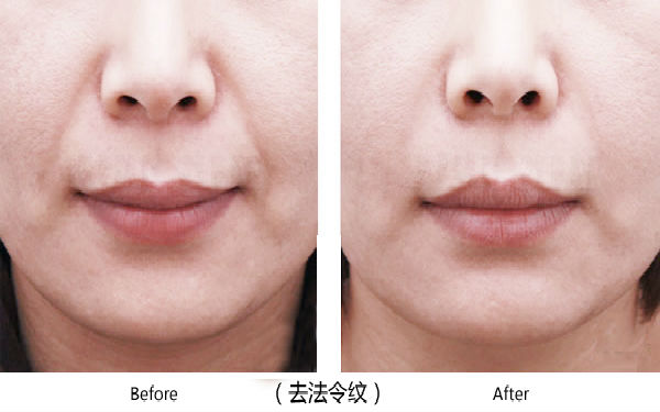 大連光電面部提拉醫(yī)院評價優(yōu)秀的有哪些？2023年排行榜揭曉！