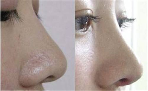 2023年北京填充川字紋凹陷醫(yī)療美容院排名前10的優(yōu)秀口碑醫(yī)院推薦，快速記錄！