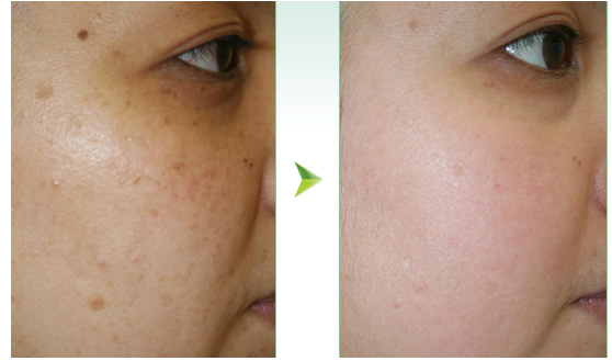 上海無針去淚溝整形醫(yī)院排行榜2023：口碑爆棚的十大醫(yī)院揭秘！