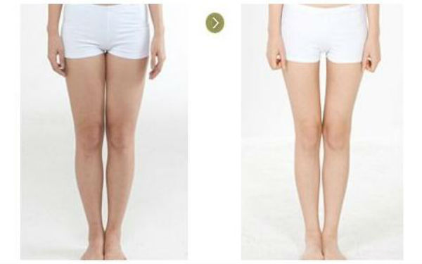 探尋煙臺綜合鼻美容醫(yī)院評價優(yōu)秀的特點！2023煙臺綜合鼻美容整形醫(yī)院口碑揭秘！