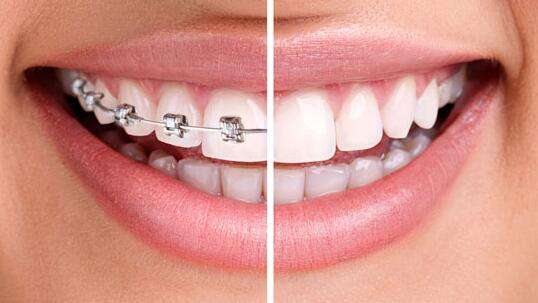 2023年10家昆明治療眼袋效果好的結(jié)膜切開醫(yī)院排行榜震撼發(fā)布