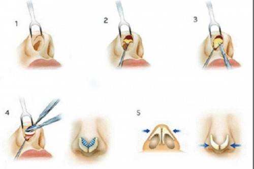 2023常德哪里可以做到去額頭紋的皮秒整形美容醫(yī)院排行榜前10強(qiáng)露面！