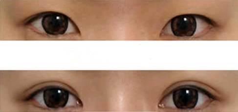 佛山口周紋有哪些醫(yī)院可以進行活細胞治療？2023排名前10的專業(yè)機構精選！