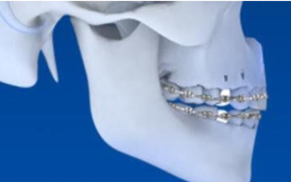 2023北京市面部整形醫(yī)院精心推薦，挑選您滿意的五官整形機構(gòu)！