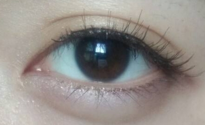 2023年強勢來襲！德州整形醫(yī)院推出全臉去痣首選，前十強榮耀問世！