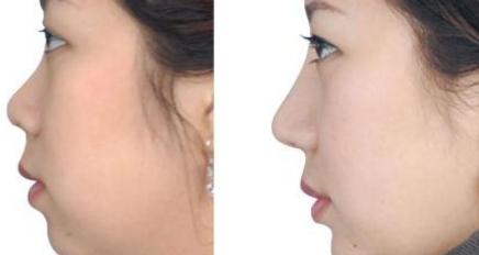 南京靜態(tài)紋醫(yī)療美容正規(guī)醫(yī)院有哪些？2023年十大排名盤點(diǎn)！