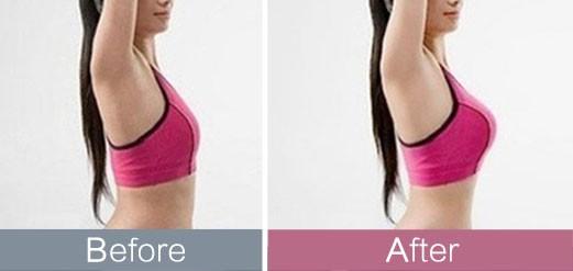 揭秘2023深圳治療抬頭紋熱門醫(yī)院排行榜top10！這些明星醫(yī)院廣受推崇，種草不斷！