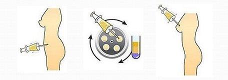 上海哪家整形醫(yī)院治療生長紋比較好？2023最可靠的前十強醫(yī)院有哪些？