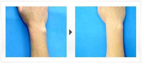 長沙微創(chuàng)印第安紋整形醫(yī)院2023年評價(jià)TOP10強(qiáng)名單發(fā)布