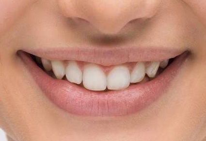 2023開封高性價(jià)比的眼角紋射頻祛除醫(yī)院排行榜TOP10已公布！