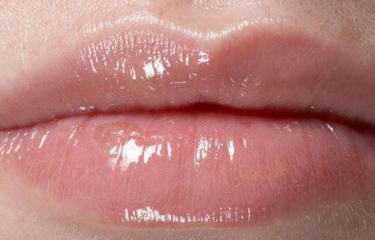 蘭州比較靠譜的去口周紋整形醫(yī)院是哪家？2023年蘭州去除口角紋綜合排名揭曉，這幾家口周紋醫(yī)療整形醫(yī)院實(shí)力