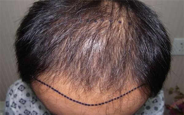 鄭州哪家整形醫(yī)院口碑好？2023年鄭州十家吸脂去雙下巴美容醫(yī)院推薦