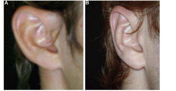 鄭州治療老年斑有口碑的整形醫(yī)院推薦！附2023年鄭州消除老年斑前十強(qiáng)排行！