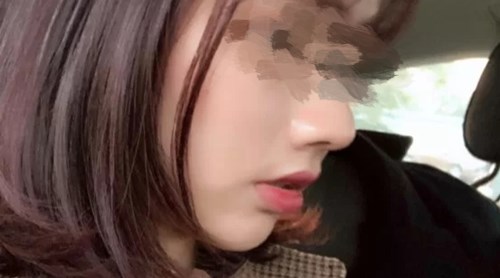 貴陽有哪些專業(yè)的磨皮去痘印醫(yī)院？2023年TOP10推薦實力醫(yī)院揭曉