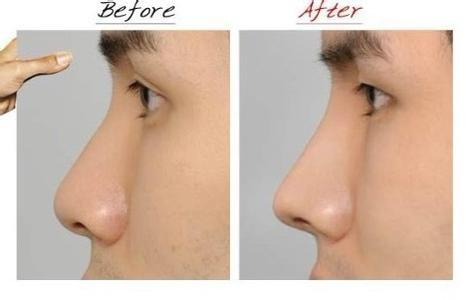 2023深圳E光腿部脫毛整形美容醫(yī)院推薦榜單前十強揭曉！這些醫(yī)院名氣大、口碑好，一定要了解！