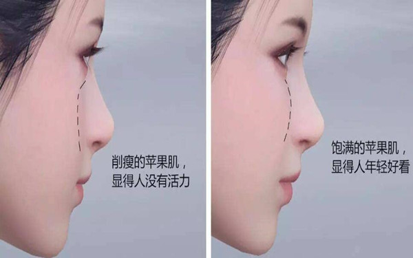 2023年青島小耳畸形矯正醫(yī)院排名榜單-前十大醫(yī)院曝光