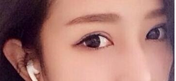 2023年山東哪些醫(yī)療美容醫(yī)院推薦度高，專業(yè)祛除眼周紋的前十家？