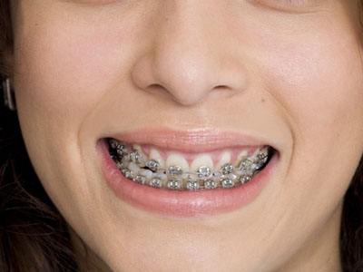 保定地區(qū)超聲炮祛額頭紋整形醫(yī)院哪些？2023排名榜前十引領(lǐng)行業(yè)