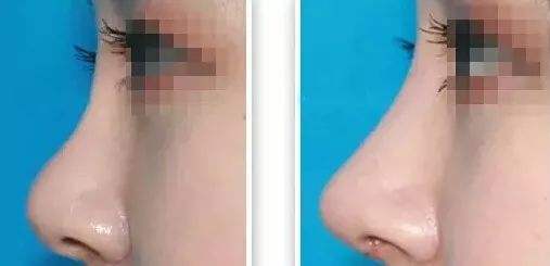 2023寧波頭部皺紋祛除醫(yī)院口碑排行榜top10公開(kāi)總結(jié)！