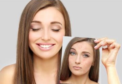 寧波有哪些微創(chuàng)定位除皺術整形醫(yī)院？2023年醫(yī)生測評揭曉排名前10位！