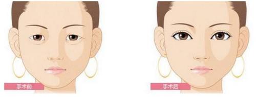 濟(jì)南哪些整形醫(yī)院在動(dòng)態(tài)細(xì)紋手術(shù)方面非常權(quán)威？2023年濟(jì)南十大專(zhuān)業(yè)動(dòng)態(tài)細(xì)紋手術(shù)醫(yī)院評(píng)測(cè)報(bào)告來(lái)襲！