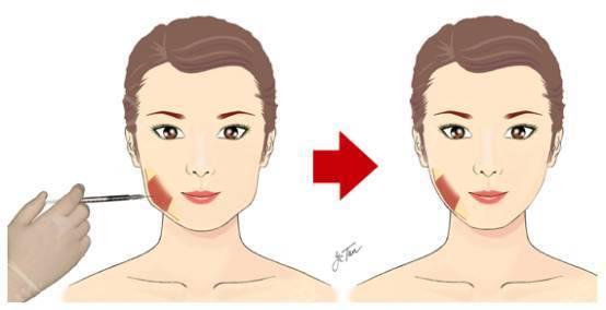 成都隆鼻整形醫(yī)院TOP10名單公布，2023年最受贊譽(yù)的美容醫(yī)院詳細(xì)概況！