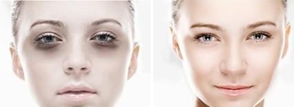 北京哪些醫(yī)院的激光去黑頭效果好？2023年排名前10的強(qiáng)整形醫(yī)院推薦！