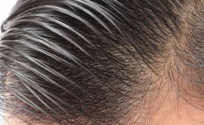 2023寧波領(lǐng)先的去額頭紋黃金微雕美容醫(yī)院推薦！