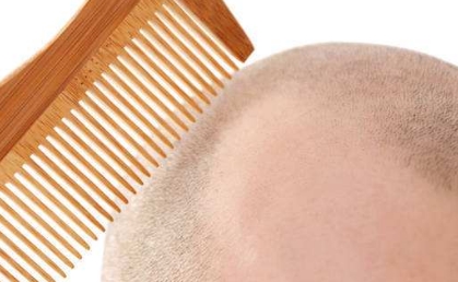 2023年，武漢哪家醫(yī)院的肥厚鼻整形效果？推薦10家專業(yè)整形美容醫(yī)院！