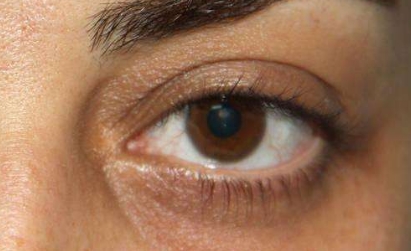 唐山哪家專業(yè)整形醫(yī)院在韓式微創(chuàng)雙眼皮恢復(fù)方面經(jīng)驗(yàn)豐富？2023年唐山醫(yī)療整形院雙眼皮恢復(fù)排名前十可信賴嗎