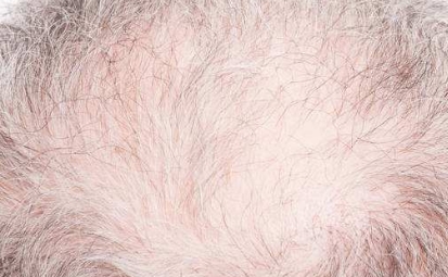 2023成都領先的隱私光電抗衰整容醫(yī)院排名前10公布！