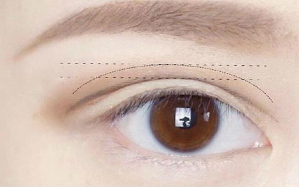 2023西安黃褐斑祛除醫(yī)院排行榜出爐！這十所醫(yī)療整形醫(yī)院備受好評(píng)！