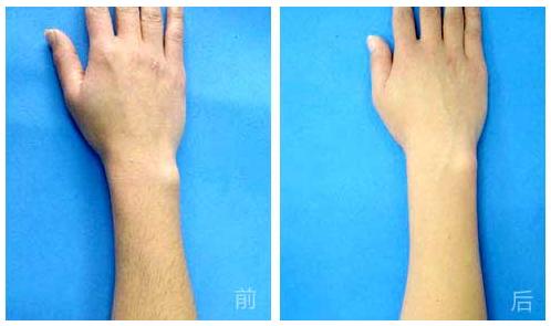 杭州哪家整形美容醫(yī)院能有效避免眼部皺紋？2023年杭州眼部皺紋美容醫(yī)院前十位排行榜來啦！