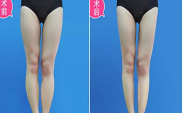 天津哪家整形醫(yī)院效果好？2023年天津太田痣激光治療正規(guī)醫(yī)院口碑前幾實(shí)力不一！