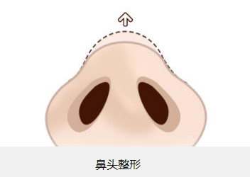 2023廈門注射豐耳垂術(shù)美容醫(yī)院前10強榜盤點，哪家口碑比較好？