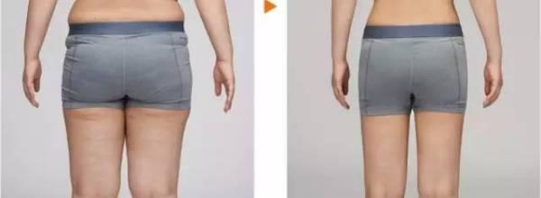 2023年北京妊娠紋整形美容機(jī)構(gòu)排名前10，哪家權(quán)威可靠？