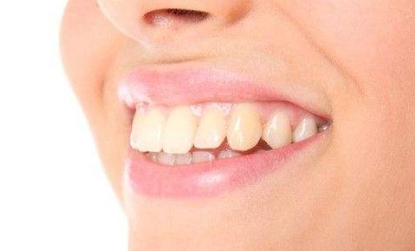 2023杭州口周紋整形醫(yī)院口碑好的有哪些？杭州物理去口周紋醫(yī)院排名揭曉！