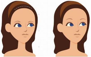 四川哪家醫(yī)院點陣激光去痘印口碑更佳？2023年四川點陣激光去痘印醫(yī)療整形醫(yī)院前十強榜單發(fā)布！